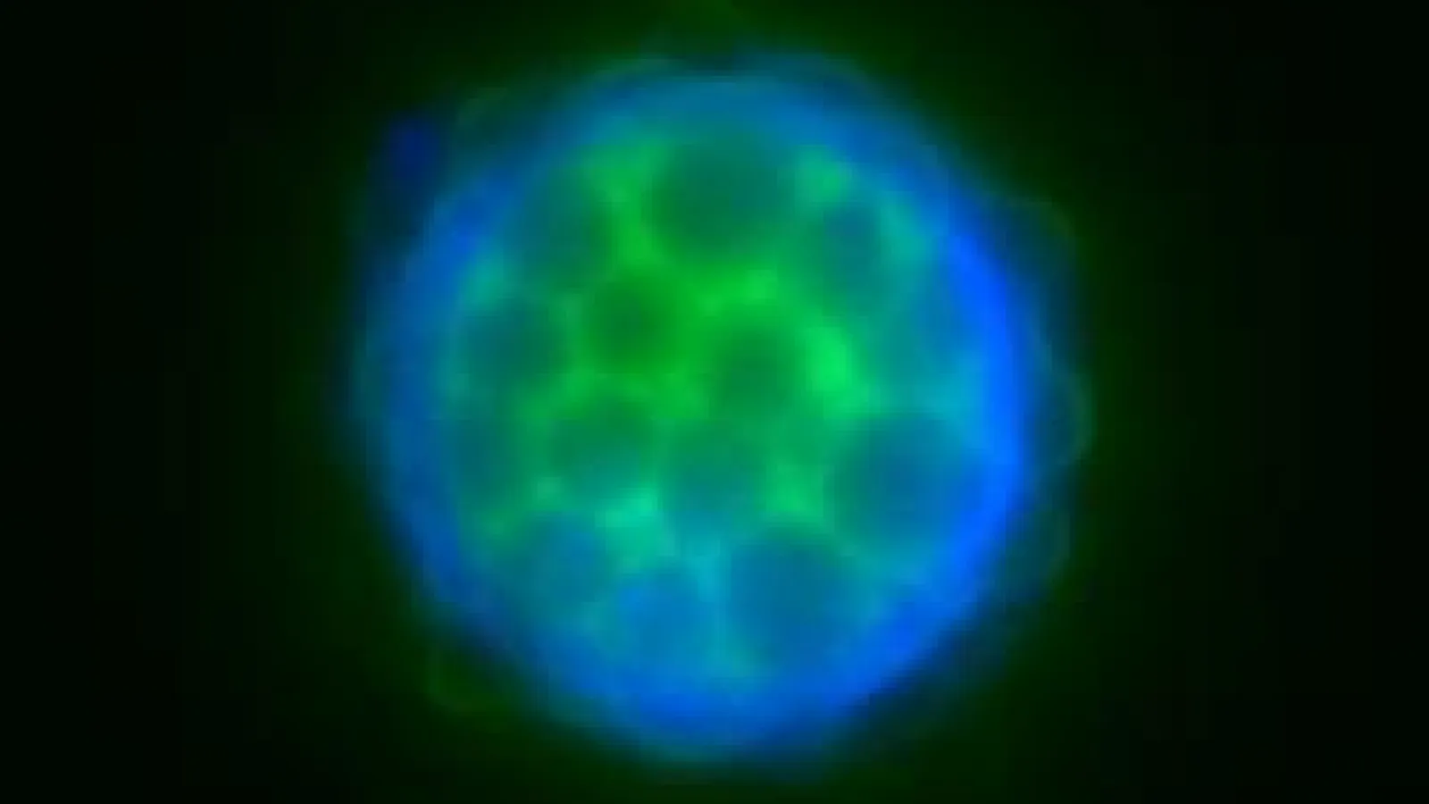 Histoplasma tuberculated macroconidia