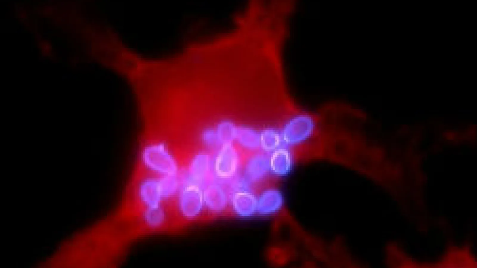Macrophage infected with histoplasma uvitex and evans blue