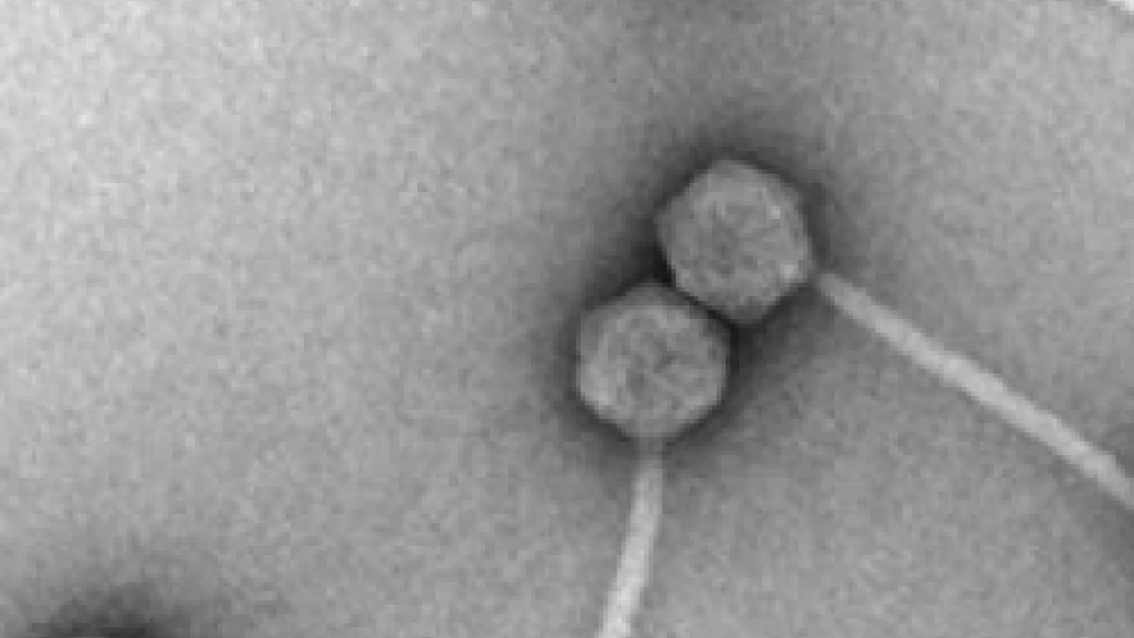 Generic virus, generic news image.