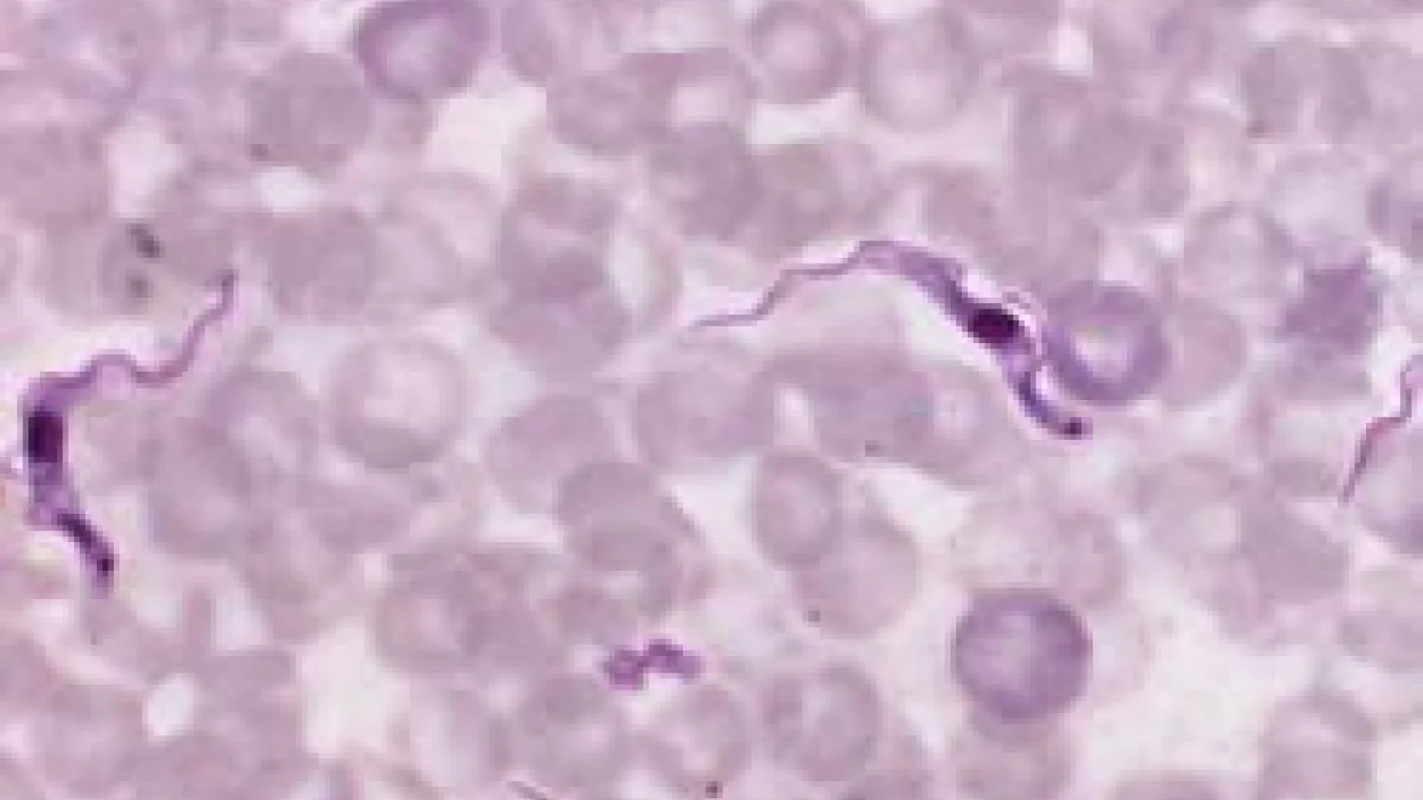 Trypanosoma Brucei.
