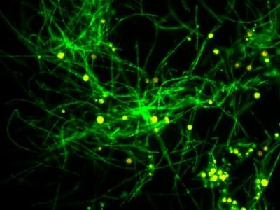 Histoplasma mycelia & conidia