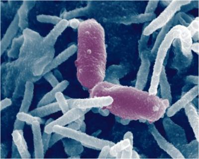 Enlarged image of undefined microorganism