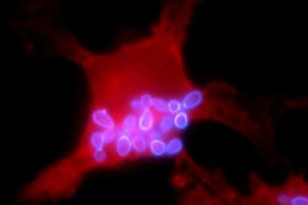 Macrophage infected with histoplasma uvitex and evans blue